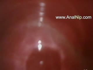 Sweet jap anal hairy adult clip